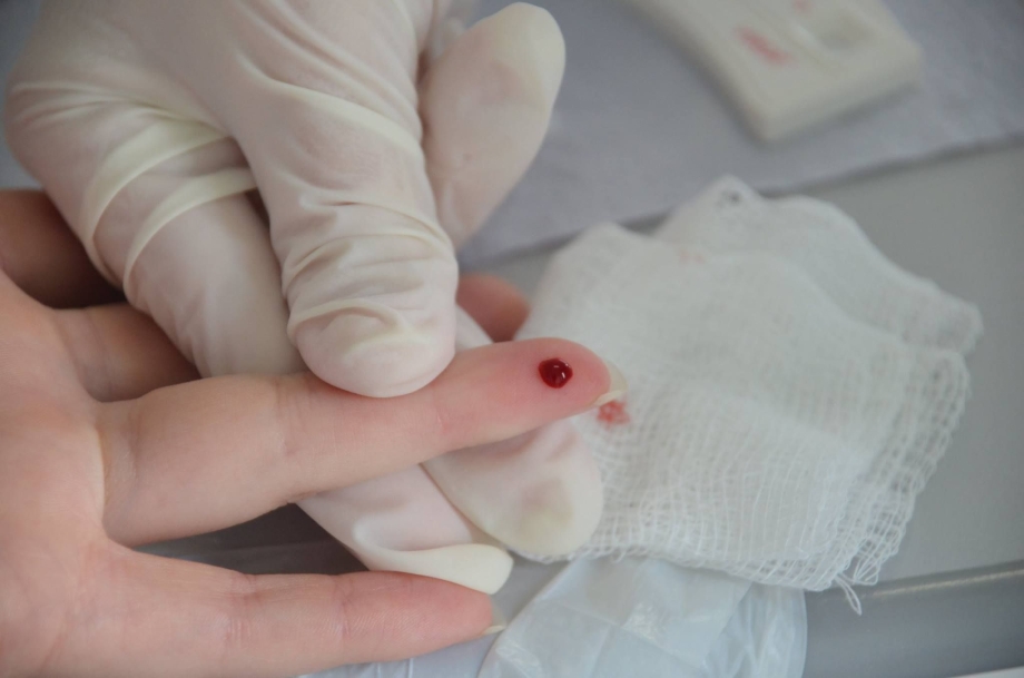 Dia D contra Hepatites oferece testes rápidos à população