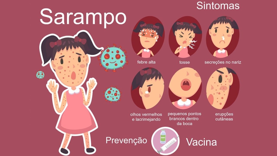 Vacinação: Sarampo